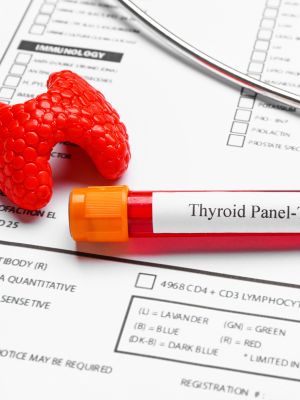 image about a complete thyroid panel blood test